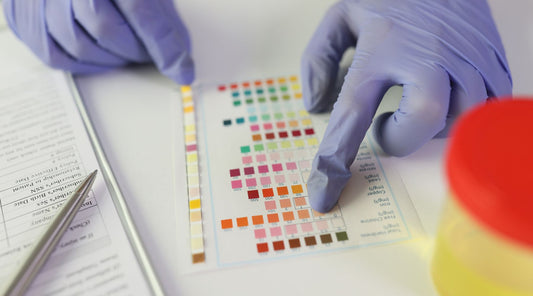 Test urinaire de stupéfiants réalisé avant une visite médicale pour récupérer le permis